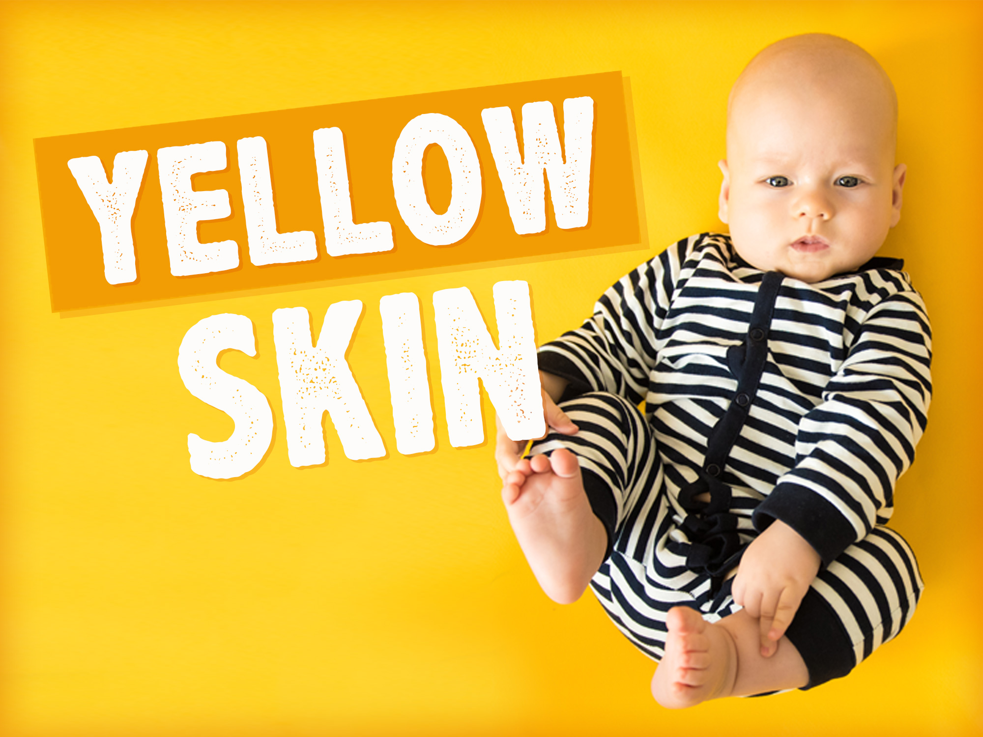 Yellow Skin